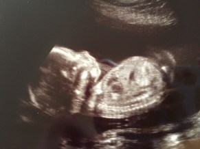 Baby Profile