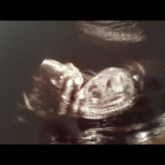 12108995_10207961692943625_2509679229447589868_n